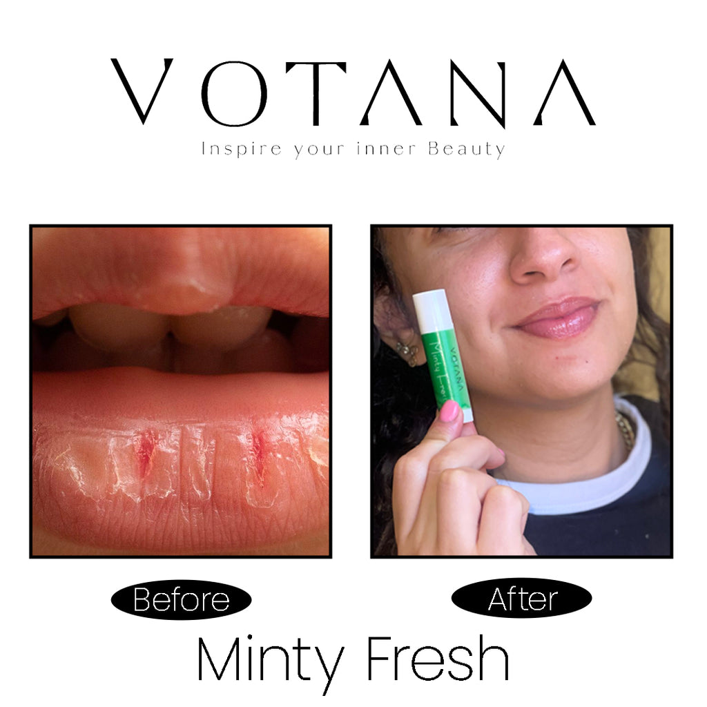 Votana Lipbalm Minty Fresh 5 ML
