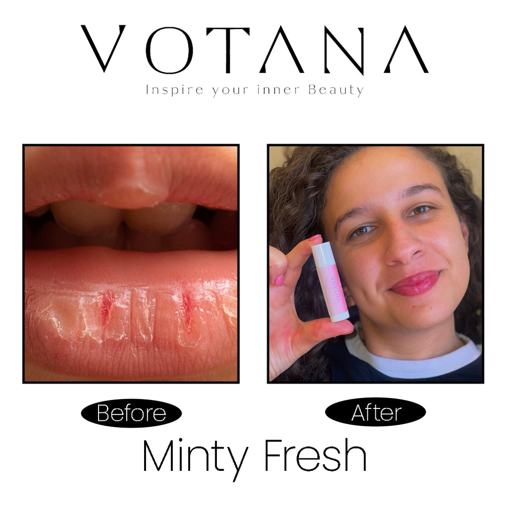 Votana Lipbalm Kiss of Flame 5 ML